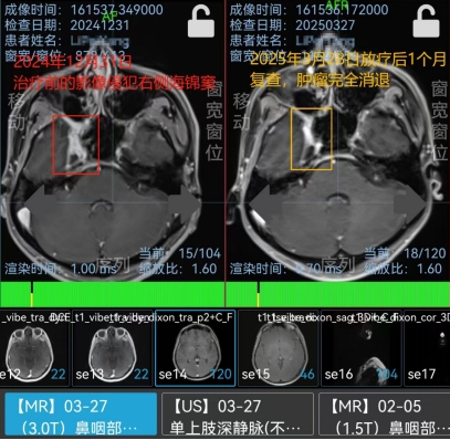CT hình ảnh dữ liệu sau khi tính giá trị