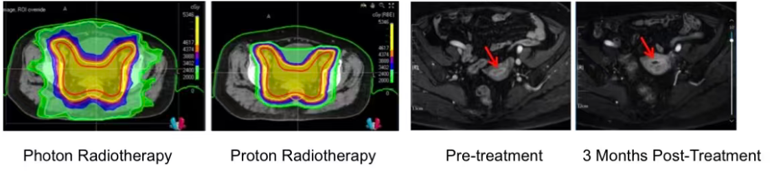 Hình ảnh trước và sau khi điều trị